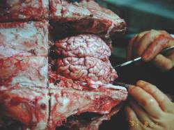 Remainders of Your Flesh